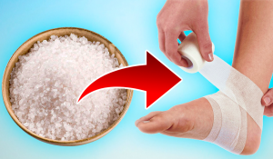 Подробнее о статье Лечение солевыми повязками — простые и эффективные способы